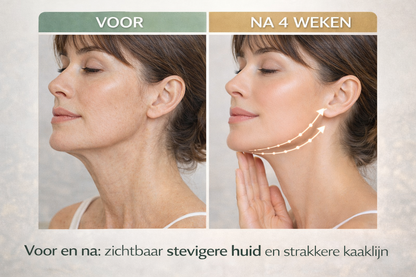 De 6 in 1 crème die huid zichtbaar strakker maakt - ZONDER dure behandelingen