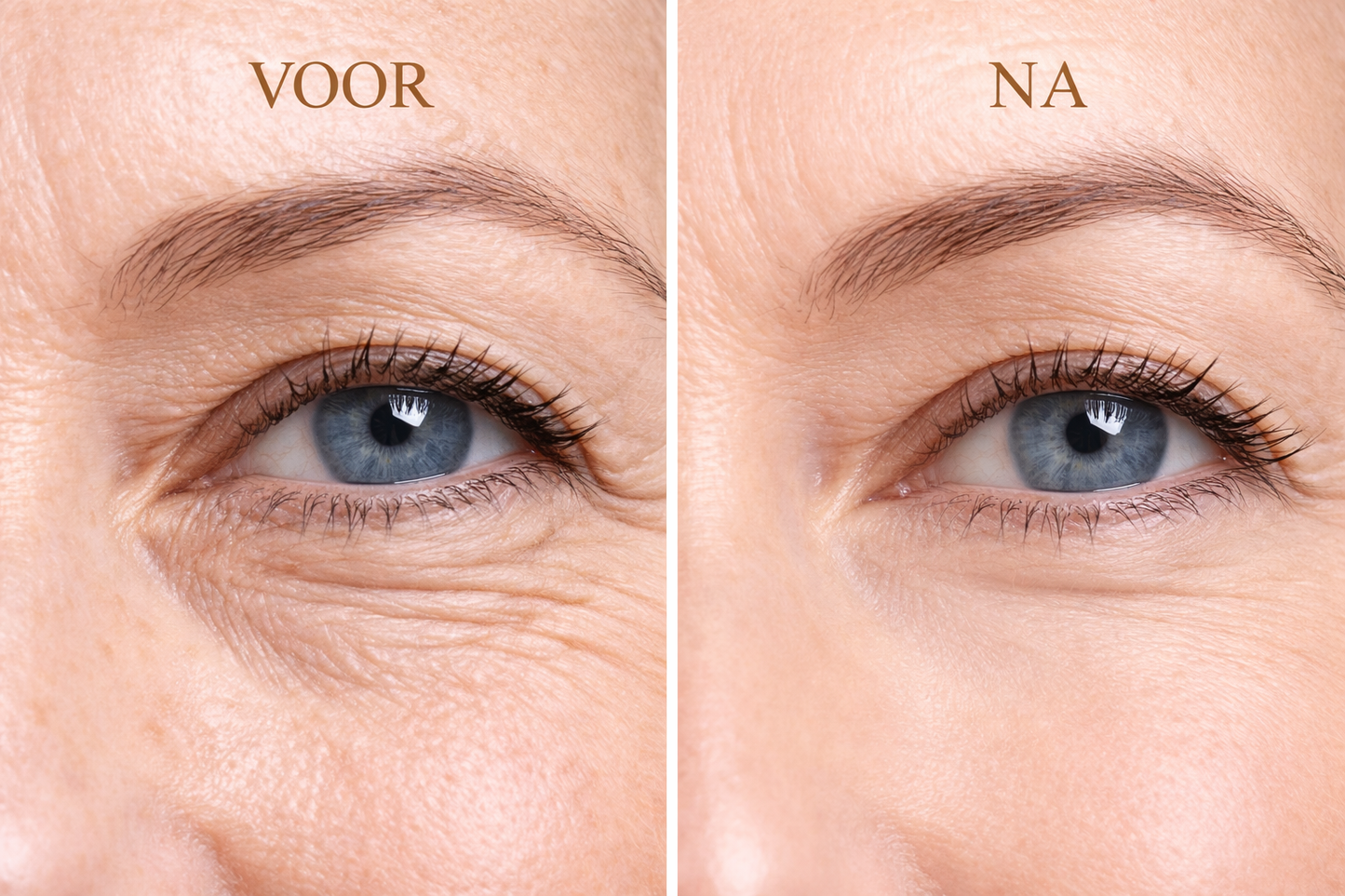 Amoora SnakeLift Anti-Rimpel Oogroller - Zichtbaar frissere, gladdere ogen – al vanaf de eerste toepassing
