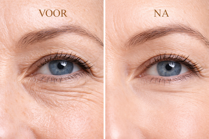 Amoora SnakeLift Anti-Rimpel Oogroller - Zichtbaar frissere, gladdere ogen – al vanaf de eerste toepassing
